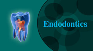 Endodontics-cover-image