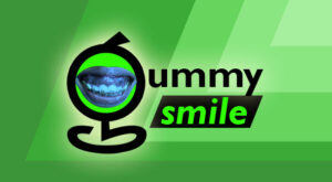 gummy-smile-cover