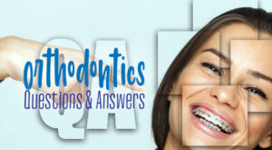 orthodontics-questions-answers