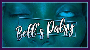 bell's palsy cover