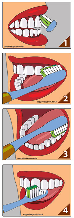 brushing-techniques