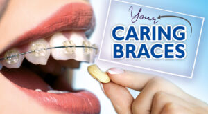 caring-your-braces