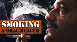 Smoking and oral health cover