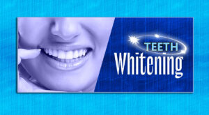 teeth-whitening