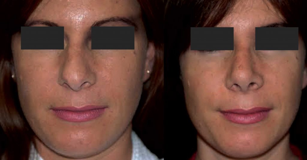 Cosmetic-surgery-Thuckalay