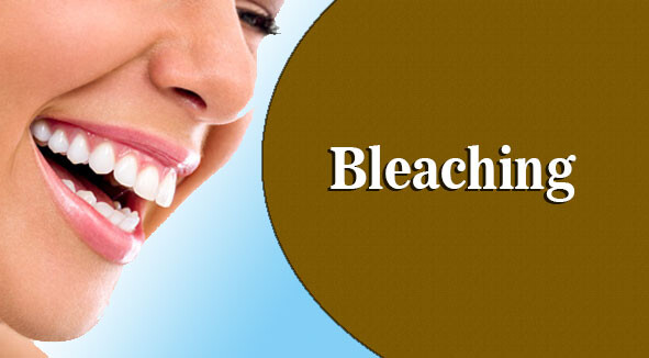 dental-bleach-cover-image