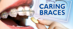 caring-your-braces