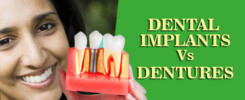 dental-implant-vs-denturecover