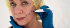 Cosmetic Surgery for Scars on the Face and Skin