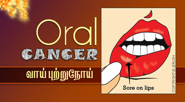 oral-cancer-cover