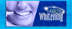 teeth-whitening